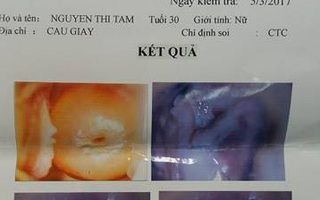 Vụ thai phụ hôn mê khi đi khám thai 1 mình: Mẹ chấn thương não, thai nhi 22 tuần tuổi vẫn bình thường