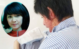 Nỗi đau và ký ức kinh hoàng của người vợ sống sót sau khi bị chồng nhốt rồi tẩm xăng cùng tự thiêu