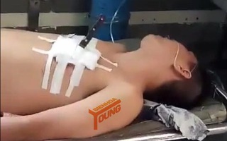 Nghi ngáo đá, nam thanh niên cầm dao xông vào tiệm áo cưới chém người rồi tự sát