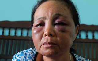 Vụ 2 người bán tăm bị đánh dã man vì nghi bắt cóc: Chúng tôi cầu xin nhưng dân làng vẫn lao vào đấm đá