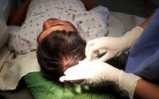 Một bác sĩ bị nam thanh niên đi cùng bệnh nhân cấp cứu đánh chảy máu đầu