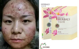 Cảnh báo: Mặt nạ giấy làm trắng giá rẻ có chứa huỳnh quang cực kì độc hại với sức khỏe