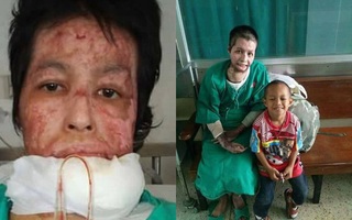 Ghen tuông, chồng tẩm xăng thiêu sống vợ khi đang nấu ăn