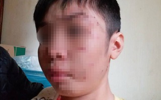 Vụ bé trai 10 tuổi bị bạo hành dã man: Mẹ kế thừa nhận bạo hành con chồng vì cháu ăn vụng thịt bò