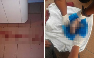 Nữ sinh năm nhất ném con trai mới sinh vào thùng rác, bé tử vong còn nguyên dây rốn