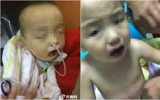 Tưởng nhầm chất tẩy là đường trắng, bé trai lấy ăn và nhập viện trong tình trạng nguy kịch
