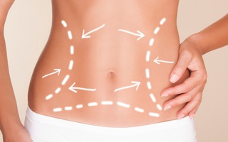 Hai phương pháp giảm cân Slimming Body đang hot nhất hiện nay