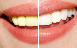 Dù có màu "vàng khè" nhưng loại gia vị này lại giúp răng trắng bật tông mà không tốn kém