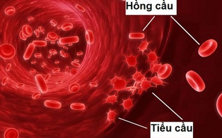 Đây là những thực phẩm tăng cường lượng tiểu cầu trong máu tự nhiên nhất bạn có thể áp dụng