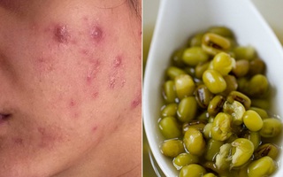 Mỗi ngày một chén chè này, cuốn bay cả mỡ thừa lẫn độc tố