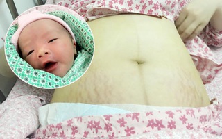 Nhật ký sinh mổ "chưa bao giờ sợ đến thế" của bà mẹ trẻ xinh đẹp