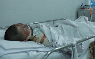 Nghi án chồng tưới xăng đốt vợ và chính mình ở Sài Gòn: Hai nạn nhân đang rất nguy kịch