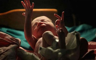 Em bé vừa chào đời, bác sĩ đặt vào túi nhựa trả về cho gia đình chôn cất thì điều ngạc nhiên xảy ra