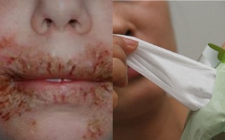 Đừng vì sự tiện lợi của bố mẹ mà khiến con chịu nhiều đau đớn nữa