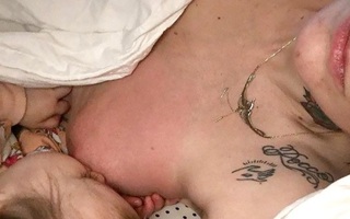 Cho con bú sai cách, ngực mẹ có thể sưng phồng, bỏng rát, đau đớn như bà mẹ này