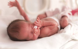Thêm những lợi ích to lớn của việc trì hoãn cắt dây rốn sau sinh