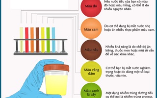 Màu sắc của nước tiểu cảnh báo tình trạng sức khỏe của bạn