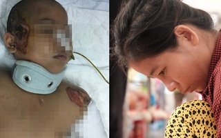 Tai nạn đau lòng: Tránh chó chạy rông, gia đình 4 người thương vong dưới bánh xe tải
