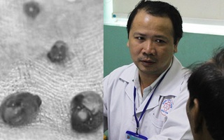 TP.HCM: Nam bệnh nhân chỉ bị tiểu buốt nhưng phòng khám buộc chặt gốc dương vật còn bắt trả 23 triệu đồng