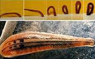 Uống nước suối, bé trai 13 tuổi bị vắt chui vào mũi