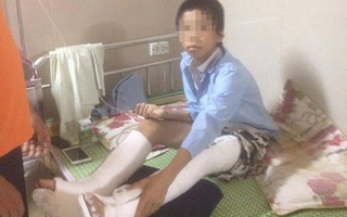 Cô giáo thu điện thoại, nam sinh nhảy từ tầng 3 xuống đất