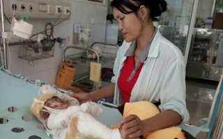 Kéo dây điện cắm ấm nước đang sôi, bé gái 15 tháng tuổi bị bỏng nặng