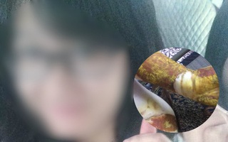 Hình ảnh nữ sinh THPT Phan Đình Phùng bị bỏng độ 3 khiến nhiều người xót xa