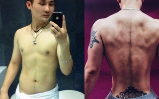 Bất chấp đau đớn, chàng trai Hà Nội chi 750 triệu đồng cắt bỏ xương sườn để có vòng eo bé xíu