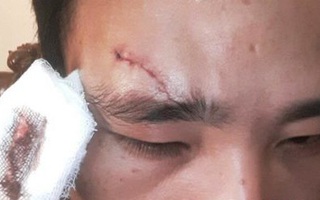 Nổi máu côn đồ giáo viên đánh đồng nghiệp toác đầu