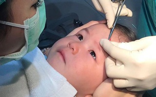 "Thanh niên cứng" tí hon quyết không khóc dù bị bác sĩ khâu sống vết thương trên trán