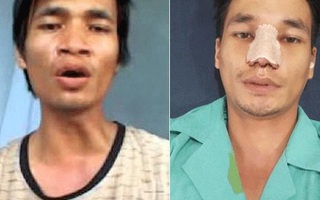 Lệ Rơi lộ hình ảnh ngỡ ngàng sau ca đại phẫu nhan sắc