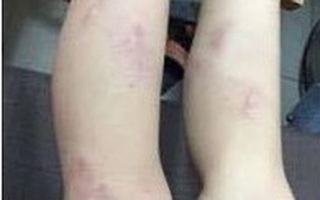 Chủ tịch HN: Làm rõ vụ 11 học sinh lớp 2 bị giáo viên bạo hành