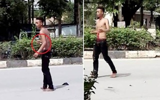 Nam thanh niên nghi “ngáo đá” tự đâm xổ ruột giữa đường