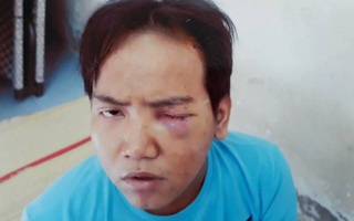 Hung thủ vụ sát hại bé 6 tuổi ở Sài Gòn khai thường hoang tưởng nghe tiếng cháu bé chửi mình