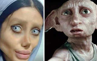 Cô gái phẫu thuật thẩm mỹ hơn 50 lần để nhìn giống Angelina Jolie, kết quả trả về gia tinh Dobby