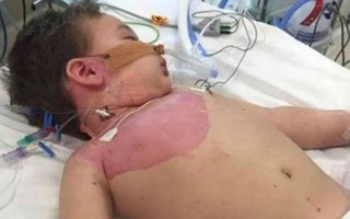 Cảnh báo căn bệnh nguy hiểm trẻ có nguy cơ mắc cao hơn vào dịp Giáng sinh