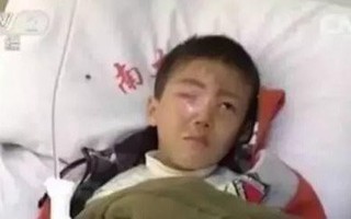 Táy máy nghịch gói hút ẩm trong hộp bánh, bé trai không may bị mù 1 mắt