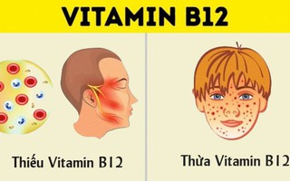 Dù bạn có nhu cầu bổ sung vitamin hay không thì cũng nên biết tất cả những thứ có liên quan đến vitamin như này