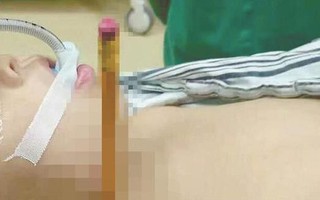 Mẹ bất ngờ phát bệnh tâm thần đâm bút chì vào cổ con gái 8 tuổi