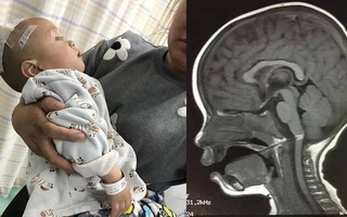 Bất cẩn đưa xúc xích xiên que cho con trai 1 tuổi, người mẹ nhận cái kết không ngờ