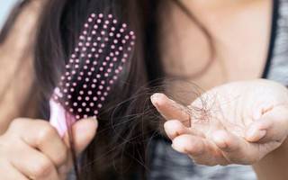 Đừng chủ quan nếu thấy tóc rụng nhiều bởi đó có thể là dấu hiệu của một vài bệnh lý nguy hiểm