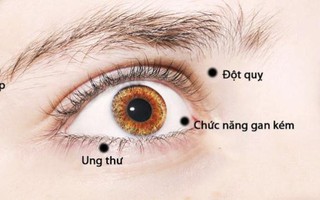 Bác sĩ nhãn khoa chỉ ra những bệnh có thể nhận biết qua đôi mắt của bạn