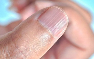 Giải mã 7 dấu hiệu bệnh lý thường thể hiện ra bên ngoài cơ thể