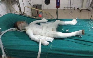 Vụ con rể đốt nhà bố vợ ở Hà Nội: Bé trai 6 tuổi bị bố dượng tẩm xăng đốt bỏng 98% đã qua đời