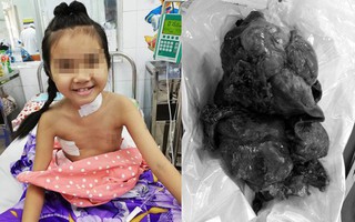 Bé gái Đồng Nai khó thở, suýt mất mạng trên bàn mổ vì mang khối u phổi chỉ 16 người trên thế giới gặp phải
