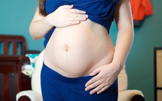 Mẹ sinh mổ không thể bỏ qua các bí quyết giúp vết mổ chóng lành sau khi sinh