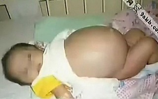 Bé 2,5 tuổi có triệu chứng như ốm nghén, đi khám bác sĩ kết luận khiến cả nhà choáng váng