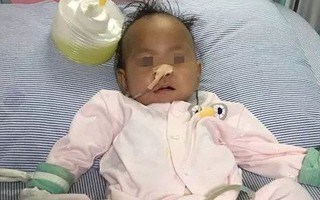 Bé gái 15 tháng tuổi bị bục dạ dày vì ăn ngô: 6 nhóm người này không nên ăn ngô