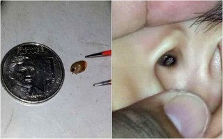 Con trai hét lên nhờ bố lấy con nhện ra khỏi tai nhưng thứ ở trong tai con khiến người cha kinh ngạc