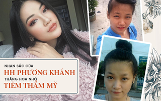 Thừa nhận tiêm thẩm mỹ, nhan sắc của Phương Khánh đã thay đổi thế nào để trở thành Tân Hoa hậu Miss Earth 2018